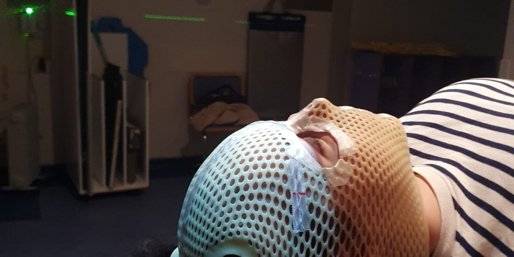 Cancer Research Patient St Lukes Hospital